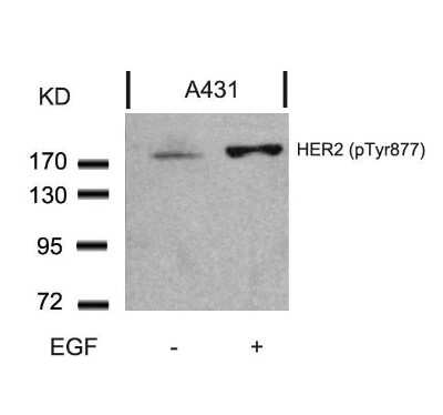 Western Blot: ErbB2/Her2 [p Tyr877] Antibody [NB100-81961]